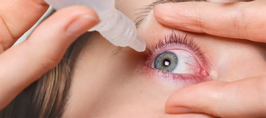 Красные пятна в глазах — почему краснеют и болят глаза?