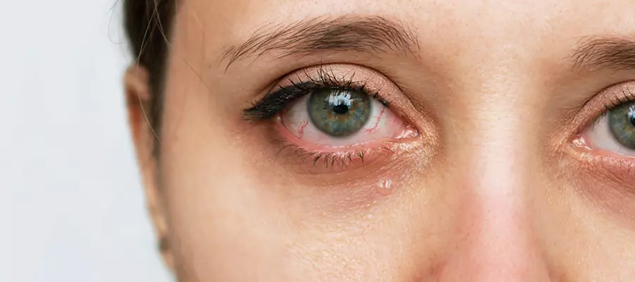 Давящая боль в глазах: причины и последствия | Блог интернет-магазина 