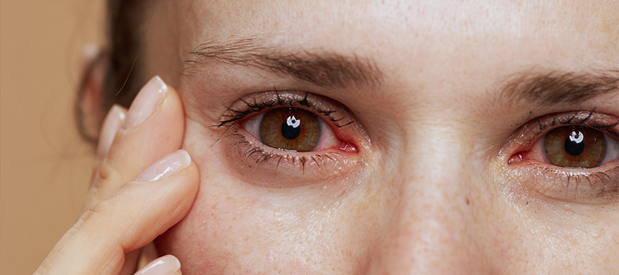 Действия при глазном воспалении